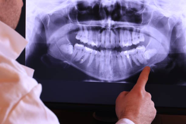 Best Cosmetic Emergency Dentistry in Sparkill, NY